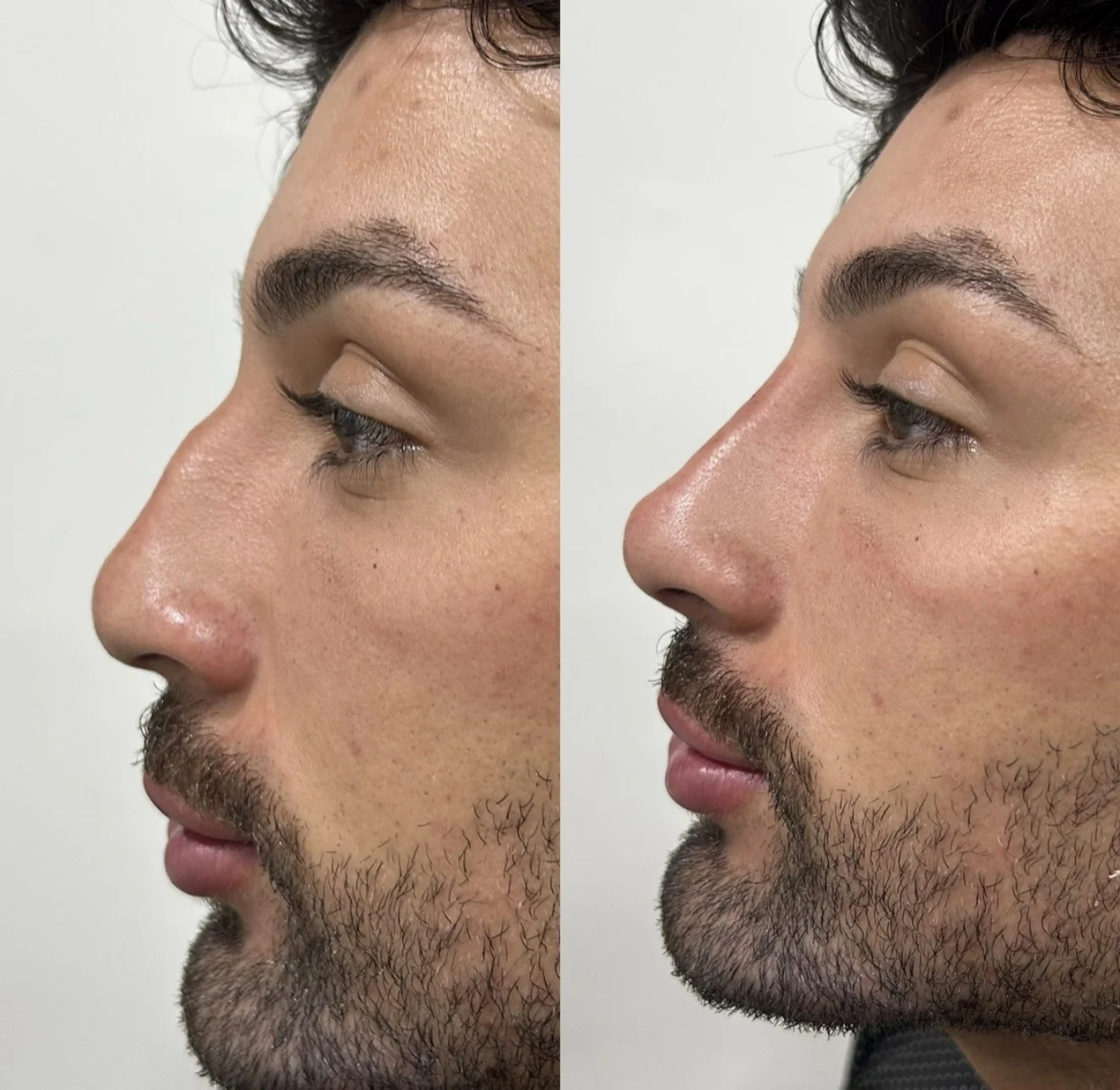 Resultado real autorizado de planejamento facial