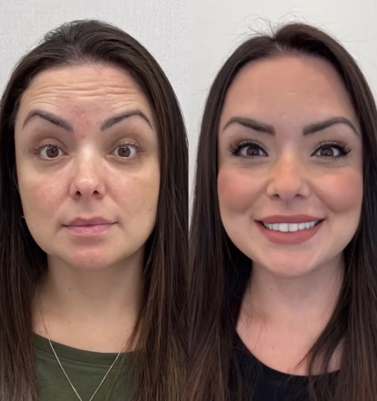 Segundo comparativo autorizado de expressões faciais, antes e depois, apresentado lado a lado