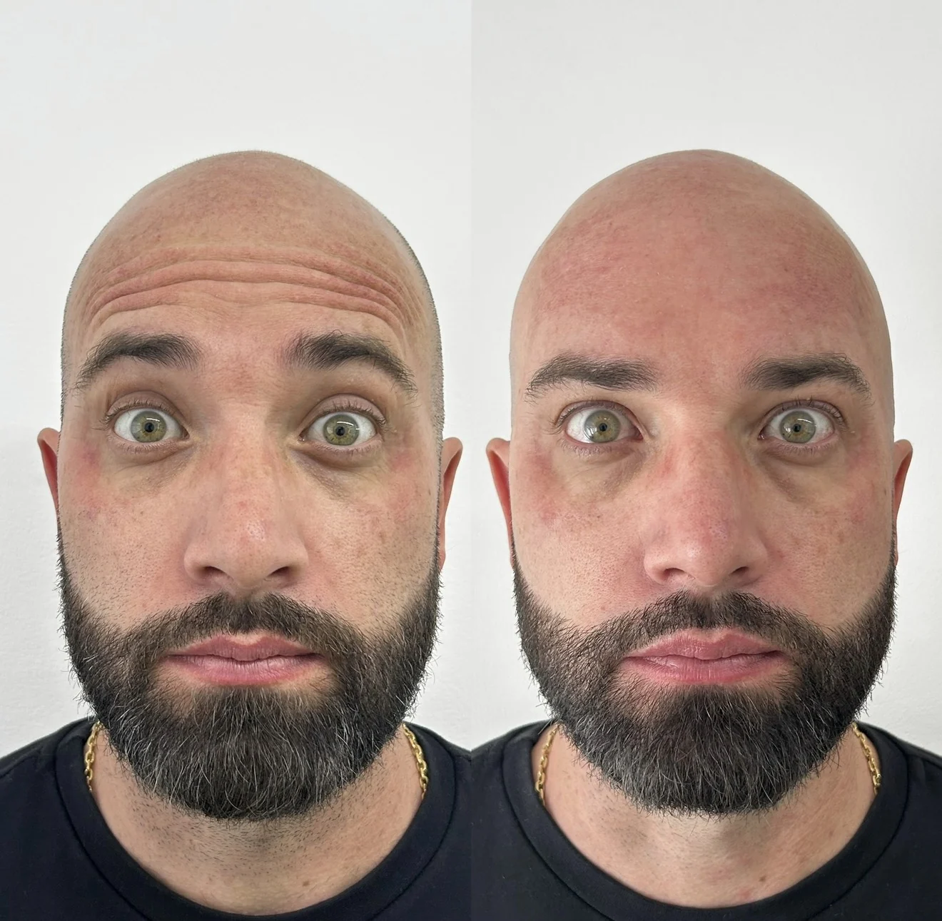 Comparativo real autorizado de planejamento facial